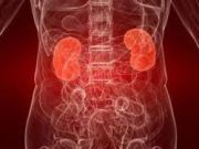 Kidney Cancer